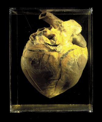 Horse's heart Phar Lap's heart