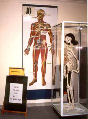 The Bionic Woman Jo'